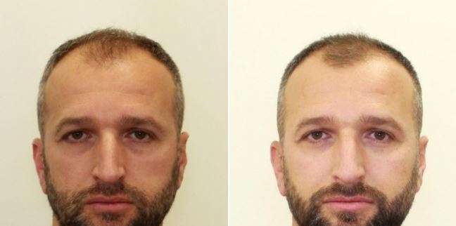 Policia kërkon ndihmën e qytetarëve për kapjen e të dyshuarit për vrasjen në Hajvali, ia publikon edhe foton